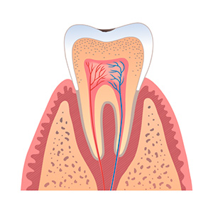 dental fillings