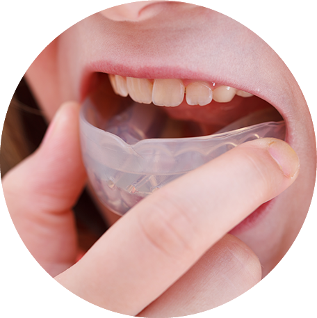 fitted mouthguard for children