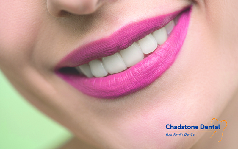 teeth straightening Melbourne